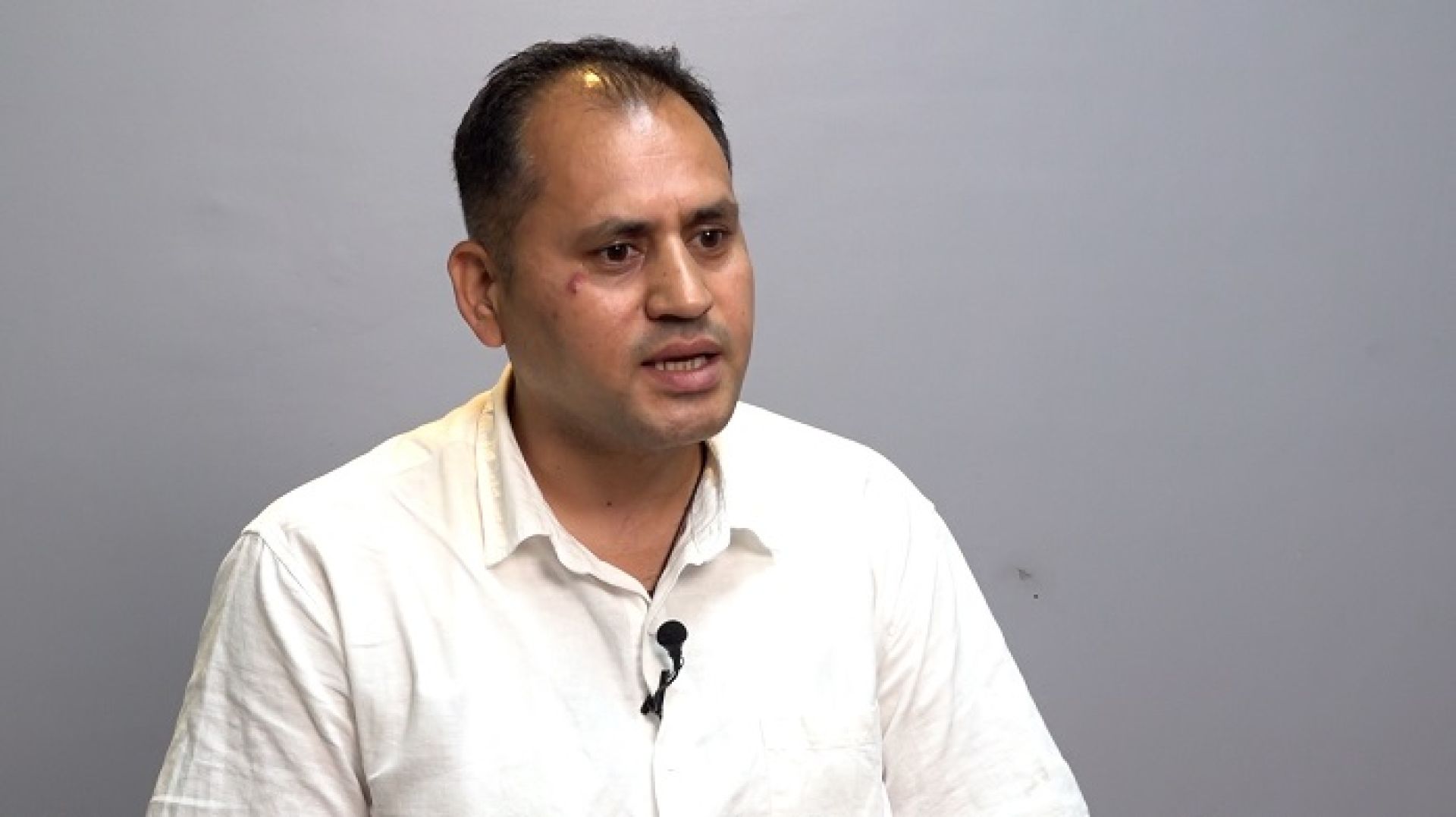 ‘नेपालका किसान सबैभन्दा उत्पीडित छन्, नार्कलाई किसानसँग जोडेमात्र नतिजा आउँछ’ 